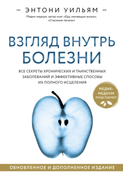 Взгляд внутрь болезни. Все секреты хронических и таинственных заболеваний и эффективные способы их полного исцеления